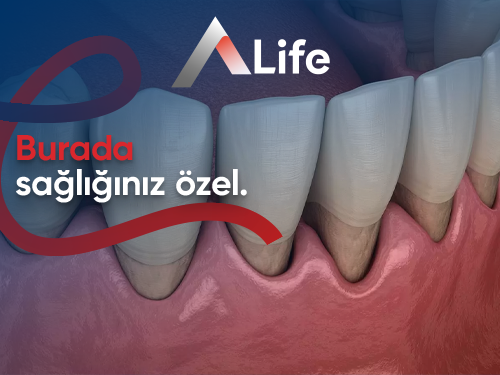 Diş Eti Çekilmesine Ne İyi Gelir?